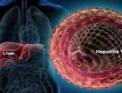 Ini Gejala Dan Pencegahan Penyakit Hepatitis Akut yang Menyerang Anak-anak